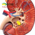 KIDNEY01 (12430) Agrandar Medical Science Órganos humanos Anatomy Adrenal Gland Model